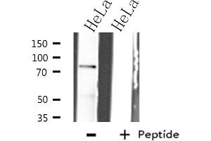 Western blot analysis of IKK-beta expression in HeLa whole cell lysates,The lane on the left is treated with the antigen-specific peptide. (IKBKB 抗体)