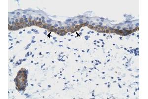 NUDT9 antibody was used for immunohistochemistry at a concentration of 4-8 ug/ml to stain Squamous epithelial cells (arrows) in Human Skin. (NUDT9 抗体)