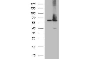 Western Blotting (WB) image for anti-Achalasia, Adrenocortical Insufficiency, Alacrimia (AAAS) (AA 322-546) antibody (ABIN2715861)