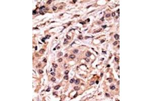 Image no. 1 for anti-Tumor Protein P53 (TP53) (pSer20) antibody (ABIN358188) (p53 抗体  (pSer20))