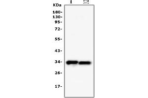 Western blot analysis of PPCS using anti-PPCS antibody (ABIN7602752).