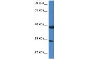 Image no. 1 for anti-HSPA Binding Protein, Cytoplasmic Cochaperone 1 (HSPBP1) (AA 226-275) antibody (ABIN6747386) (HSPBP1 抗体  (AA 226-275))