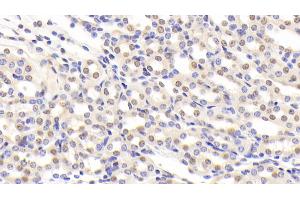 Detection of NCL in Mouse Kidney Tissue using Polyclonal Antibody to Nucleolin (NCL) (Nucleolin 抗体  (AA 353-568))