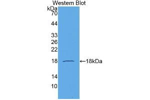 Western blot analysis of the recombinant protein. (CCL21 抗体  (AA 24-134))