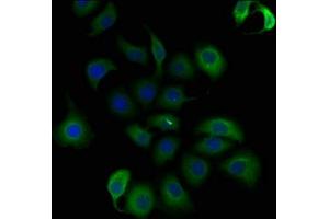 Immunofluorescence staining of A549 cells with ABIN7140197 at 1:50, counter-stained with DAPI. (Trichohyalin 抗体  (AA 1922-1941))