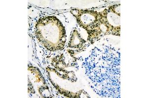 IHC analysis of NF1 using anti-NF1 antibody (ABIN7600195).