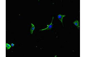 Immunofluorescent analysis of U251 cells using ABIN7158030 at dilution of 1:100 and Alexa Fluor 488-congugated AffiniPure Goat Anti-Rabbit IgG(H+L) (LZTFL1 抗体  (AA 116-299))
