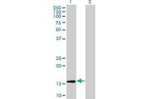 Western Blot analysis of RPL30 expression in transfected 293T cell line by RPL30 monoclonal antibody (M01), clone 4E6. (RPL30 抗体  (AA 1-115))