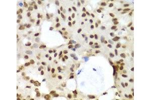 Immunohistochemistry (Paraffin-embedded Sections) (IHC (p)) image for anti-Ligase III, DNA, ATP-Dependent (LIG3) antibody (ABIN7257088)