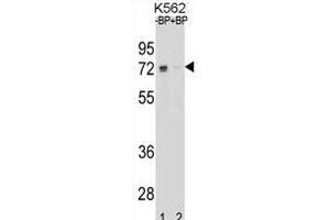 Western blot analysis of ESR1 isoform1 Antibody (C-term) Pab (ABIN1881317 and ABIN2838677) pre-incubated without(lane 1) and with(lane 2) blocking peptide in K562 cell line lysate. (Estrogen Receptor alpha 抗体  (C-Term))