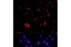 Immunofluorescence analysis of U2OS cells using HUS1 Polyclonal Antibody (HUS1 抗体)