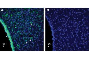 Expression of GPR18 in rat dorsomedial hypothalamus. (GPR18 抗体  (Extracellular))