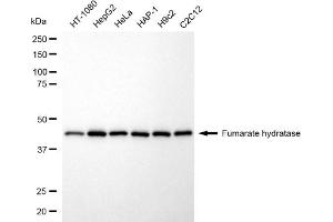 Western blotting analysis using fumarate hydratase antibody (ABIN7798665). (FH 抗体)