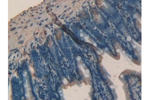 Immunohistochemistry (IHC) image for anti-Transferrin Receptor 2 (TFR2) (AA 86-259) antibody (ABIN7431467)