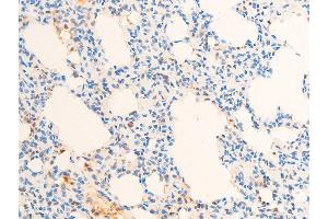 ABIN6267307 at 1/100 staining rat lung tissue sections by IHC-P. (C-JUN 抗体  (pThr93))