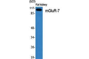 Western Blot (WB) analysis of specific cells using mGluR-7 Polyclonal Antibody.