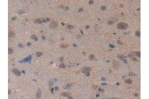 Used in DAB staining on fromalin fixed paraffin- embedded kidney tissue (GCLC 抗体  (AA 435-636))
