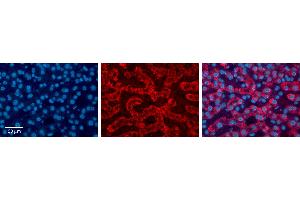 Immunohistochemistry (IHC) image for anti-Acetyl-CoA Acyltransferase 1 (ACAA1) (N-Term) antibody (ABIN2783261)