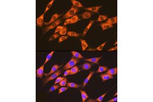 Immunofluorescence analysis of NIH-3T3 cells using RA + RB Rabbit mAb (ABIN7269853) at dilution of 1:100 (40x lens). (RAP1A + RAP1B 抗体)