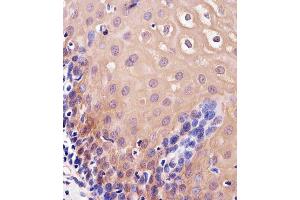 Immunohistochemical analysis of paraffin-embedded H. (TXN 抗体  (C-Term))