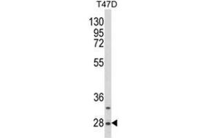 Western blot analysis of SNRPB Antibody (N-term R49) Cat.