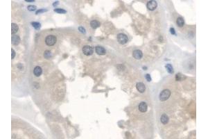 Immunohistochemistry (IHC) image for anti-V-Erb-A erythroblastic Leukemia Viral Oncogene Homolog 4 (Avian) (ERBB4) (AA 29-278) antibody (ABIN7440776)
