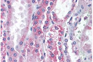 Immunohistochemistry (IHC) image for anti-Transient Receptor Potential Cation Channel, Subfamily V, Member 1 (TRPV1) (Internal Region) antibody (ABIN1049437)