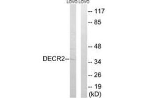 Western blot analysis of extracts from LOVO cells, using DECR2 Antibody. (DECR2 抗体  (AA 217-266))