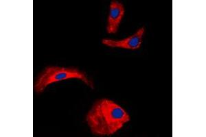Immunofluorescent analysis of OLFML2A staining in HepG2 cells. (OLFML2A 抗体  (Center))