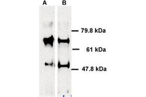 Human ABCE1 detected in immunoprecipitated samples using ABCE1 polyclonal antibody . (ABCE1 抗体)