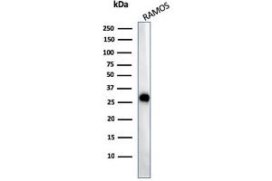 Western Blot Analysis of Ramos cell lysate using HLA-Pan Mouse Monoclonal Antibody (CR3/43). (MHC Class II HLA-DP/DQ/DR 抗体)