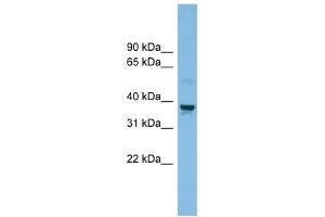 SLC30A3 antibody used at 1 ug/ml to detect target protein. (Slc30a3 抗体)