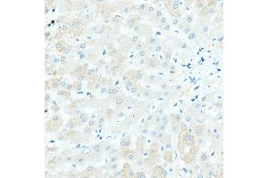 Immunohistochemistry (IHC) image for anti-IgD antibody (ABIN7267824)