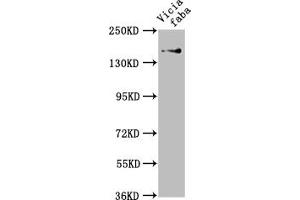 Western Blot Positive WB detected in: Vicia faba leaf tissue All lanes: GLU1 antibody at 1:1000 Secondary Goat polyclonal to rabbit IgG at 1/50000 dilution Predicted band size: 177, 180 kDa Observed band size: 177 kDa (GLU1 (AA 106-505) 抗体)
