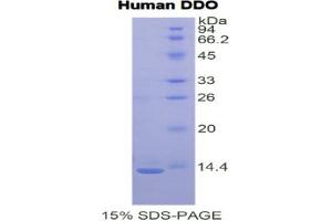 SDS-PAGE analysis of Human D-Aspartate Oxidase Protein. (DDO 蛋白)