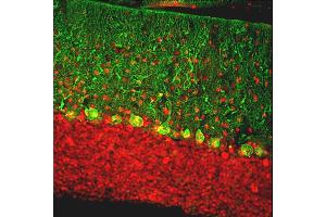 Immunofluorescent analysis of rat cerebellum section stained with chicken pAb to calbindin, ABIN8126692, dilution 1:2,000, in green, and costained with rabbit pAb to MeCP2, dilution 1:5,000, in red. (CALB1 抗体)