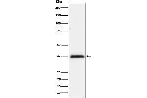 Western blot analysis of RGMA expression in Hela cell lysate.