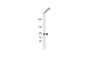 Anti-VAV3 Antibody (Cterm) at 1:2000 dilution + human kidney lysate Lysates/proteins at 20 μg per lane. (VAV3 抗体  (C-Term))