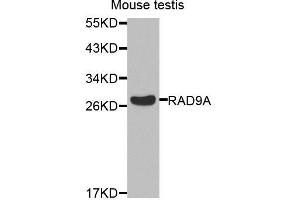 Western blot analysis of extracts of mouse testis, using RAD9A antibody. (RAD9A 抗体  (AA 162-391))
