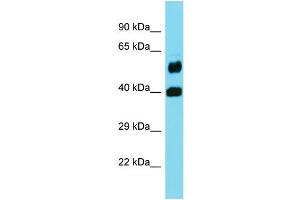 Western Blotting (WB) image for anti-Folate Hydrolase 1B (FOLH1B) (Middle Region) antibody (ABIN2436969) (FOLH1B 抗体  (Middle Region))