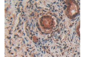 Immunohistochemistry (IHC) image for anti-Spectrin alpha Chain, Brain (SPTAN1) (AA 1004-1181) antibody (ABIN1172707)