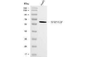 Western blot analysis of SPATA18 using anti-SPATA18 antibody (ABIN7601020).