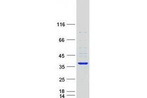 Western Blotting (WB) image for Sulfotransferase Family 1B Member 1 (SULT1B1) protein (Myc-DYKDDDDK Tag) (ABIN2732950)