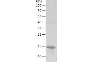 eIF4EBP2 Protein (AA 1-120) (His tag)