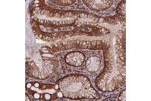 Immunohistochemical staining of human stomach with EHBP1L1 polyclonal antibody  shows strong cytoplasmic positivity in glandular cells.