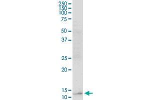 RBP5 MaxPab polyclonal antibody. (Retinol Binding Protein 5 抗体  (AA 1-135))