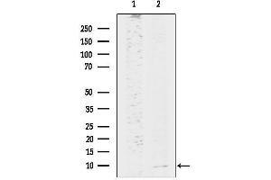anti-Hepcidin Antimicrobial Peptide (HAMP) (Internal Region) antibody