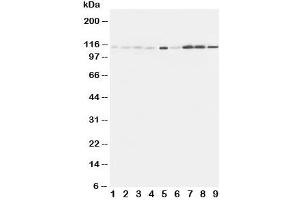Western blot testing of EphA1 antibody and Lane 1:  rat liver
