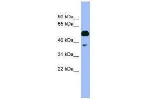 WB Suggested Anti-PSMC4 Antibody Titration: 0. (PSMC4 抗体  (N-Term))