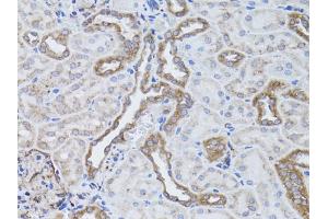 Immunohistochemistry of paraffin-embedded rat kidney using ITGAV antibody. (CD51 抗体)